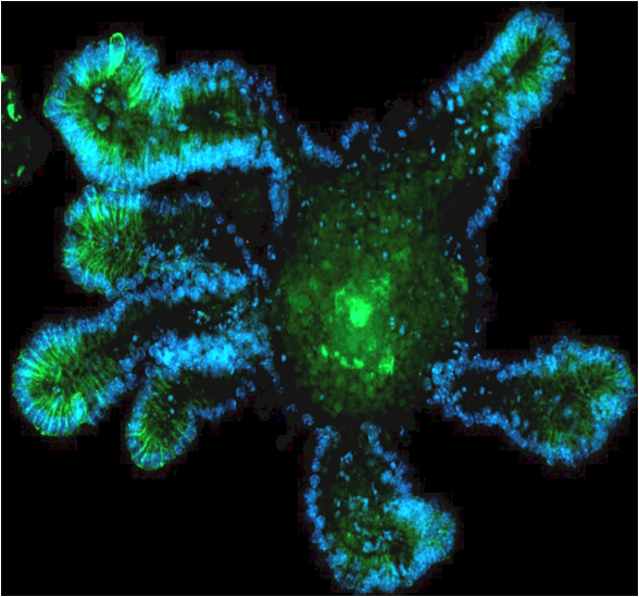 Organoid_Intestine